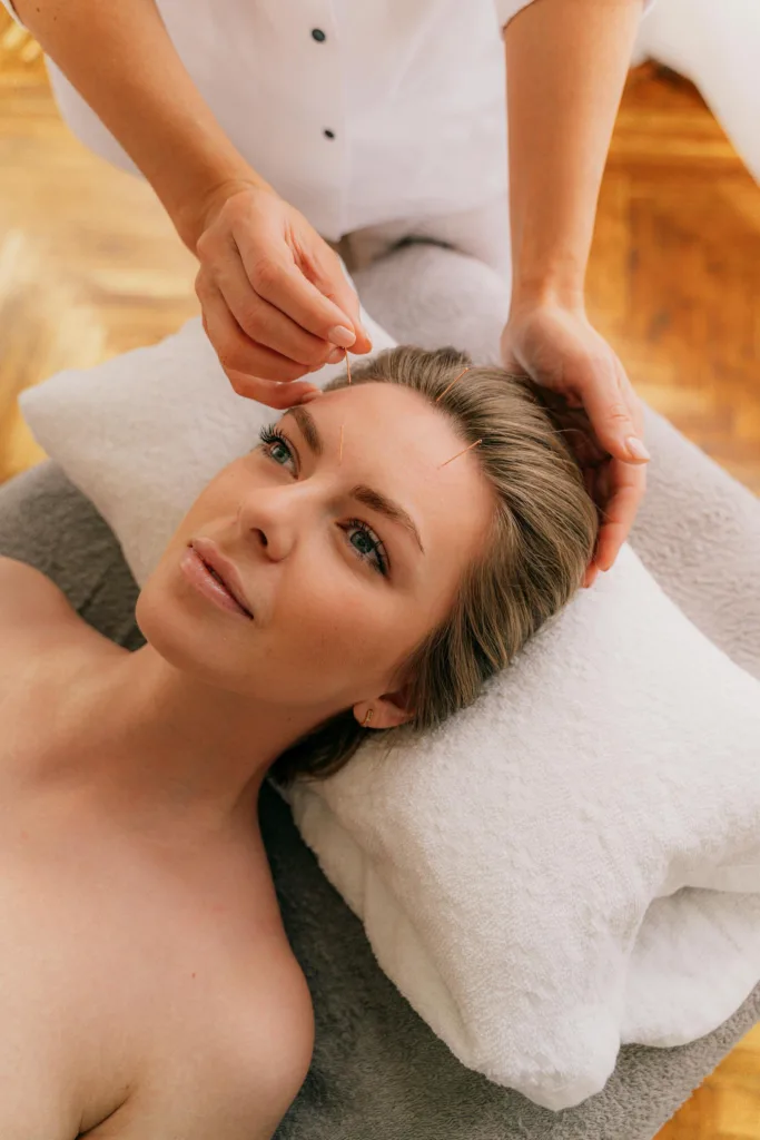 facial acupuncture